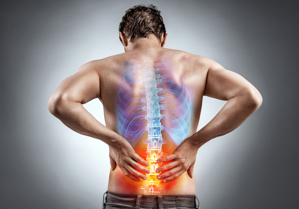 3 Things You Need to Know About Sciatica