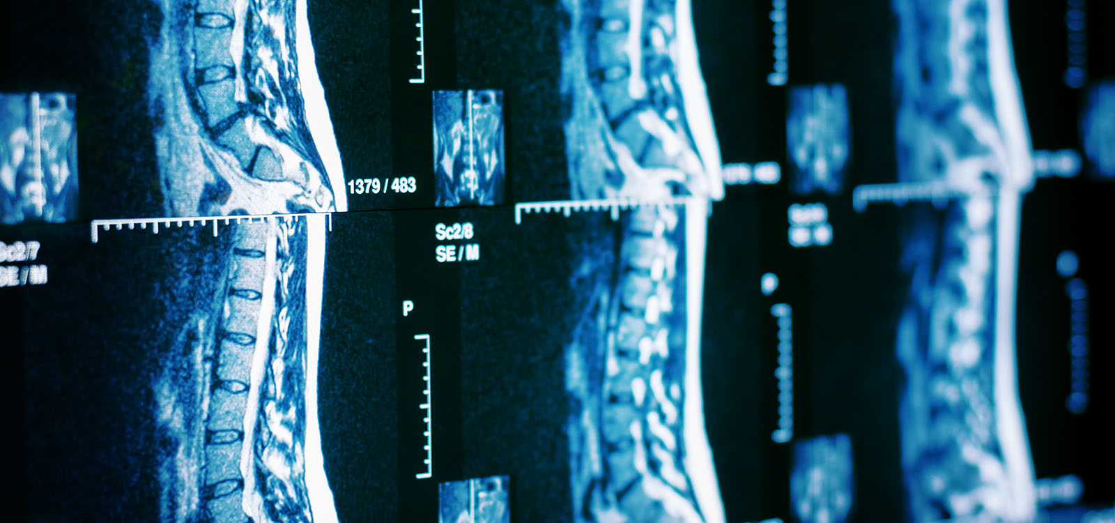 MRI and XRAY Atlantic Spine Specialists Morristown NJ