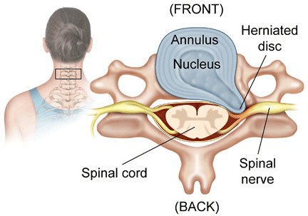 Cervical Spine