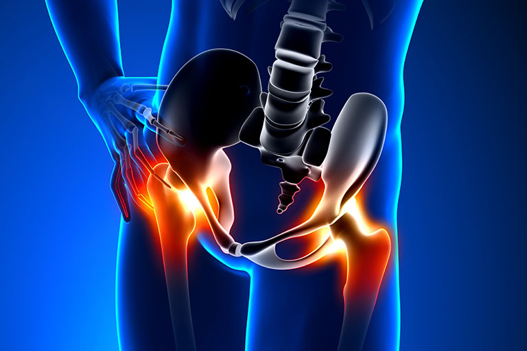 https://atlanticspinespecialists.com/wp-content/uploads/2022/02/Causes-of-Lower-Back-and-Hip-Pain.jpg