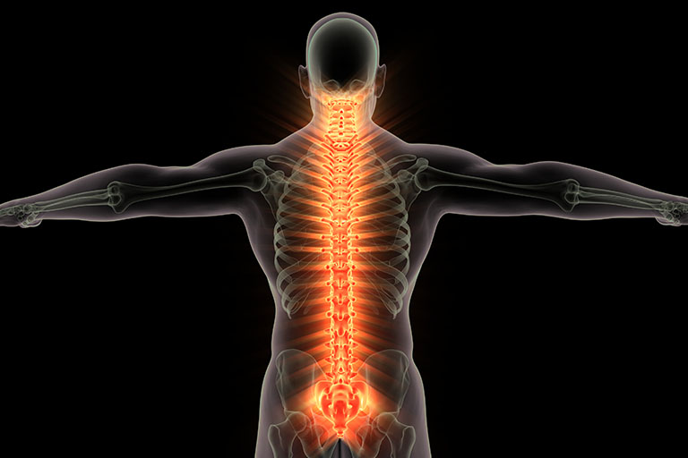 7 Tips for a Healthy Spine